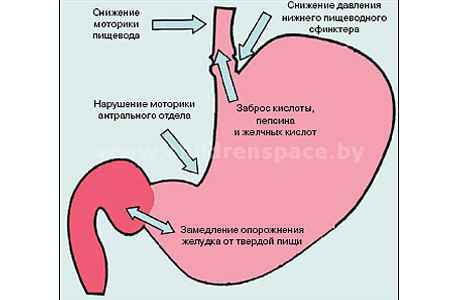 процессы  в  желудке -  схема